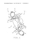 Dental repositioning device diagram and image