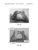 DENTAL CASTING BILLET MATERIAL, METAL POWDER FOR POWDER METALLURGY, DENTAL     METAL COMPONENT, AND DENTAL PROSTHESIS diagram and image