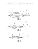 CATHETER-BASED APPARATUSES AND METHODS diagram and image