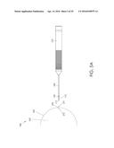 CANNULA INGRESS SYSTEM diagram and image