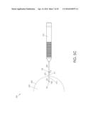 CANNULA INGRESS SYSTEM diagram and image