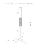 CANNULA INGRESS SYSTEM diagram and image