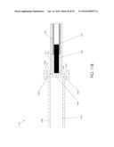 CANNULA INGRESS SYSTEM diagram and image