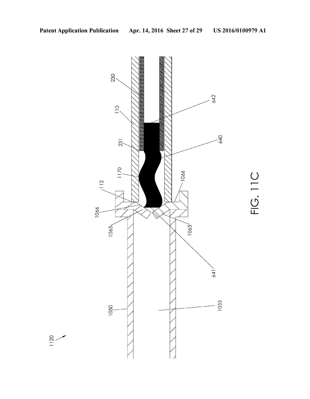 CANNULA INGRESS SYSTEM - diagram, schematic, and image 28