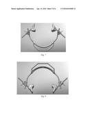 Jaw Thrust Device and Method diagram and image