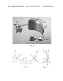 Jaw Thrust Device and Method diagram and image