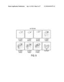 ACAMPROSATE FORMULATIONS, METHODS OF USING THE SAME, AND COMBINATIONS     COMPRISING THE SAME diagram and image