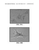 COMPOSITIONS COMPRISING NANOPARTICLES AND APOPTOTIC AGENTS AND METHODS OF     USE diagram and image