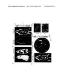 USE OF A TRUNCATED CCN1 PROMOTER FOR CANCER DIAGNOSTICS, THERAPEUTICS AND     THERANOSTICS diagram and image