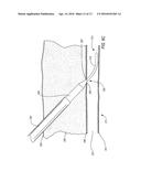 MEDICAL GUIDE ELEMENT WITH DIAMETER TRANSITION diagram and image