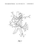 Method and Apparatus for Stimulating the Vascular System diagram and image