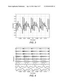 Neural Coding with Short Inter Pulse Intervals diagram and image