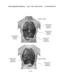 SYSTEMS AND METHODS FOR MARTIAL ARTS TRAINING DEVICES WITH ANATOMICALLY     ACCURATE FORCE, PRESSURE AND OTHER RESPONSE diagram and image