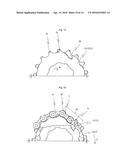 MULTI-SPROCKET ARRANGEMENT FOR A BICYCLE diagram and image