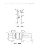 SLIDER BAG WITH A DETENT diagram and image