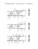 SLIDER BAG WITH A DETENT diagram and image