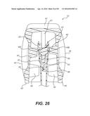 SLIDER BAG WITH A DETENT diagram and image