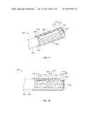 SYSTEMS AND METHODS FOR FORMING A CONDUCTIVE WIRE ASSEMBLY diagram and image