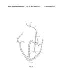 CARDIAC FUNCTION EVALUATION SYSTEM diagram and image