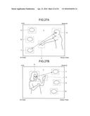 DIAGNOSIS SUPPORTING DEVICE AND DIAGNOSIS SUPPORTING METHOD diagram and image