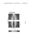 ULTRASONIC ARRAY FOR BONE SONOGRAPHY diagram and image