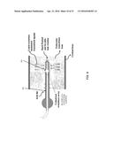 ULTRASONIC ARRAY FOR BONE SONOGRAPHY diagram and image