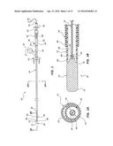 BIORESORBABLE DETACHABLE TIP DESIGN FOR ADHESIVE-BASED EXTRAVASCULAR     CLOSURE DEVICE diagram and image