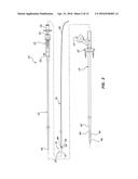 BIORESORBABLE DETACHABLE TIP DESIGN FOR ADHESIVE-BASED EXTRAVASCULAR     CLOSURE DEVICE diagram and image