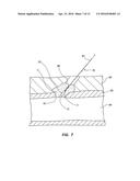 BIORESORBABLE DETACHABLE TIP DESIGN FOR ADHESIVE-BASED EXTRAVASCULAR     CLOSURE DEVICE diagram and image