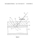 BIORESORBABLE DETACHABLE TIP DESIGN FOR ADHESIVE-BASED EXTRAVASCULAR     CLOSURE DEVICE diagram and image