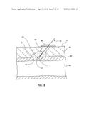 BIORESORBABLE DETACHABLE TIP DESIGN FOR ADHESIVE-BASED EXTRAVASCULAR     CLOSURE DEVICE diagram and image