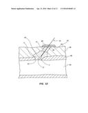 BIORESORBABLE DETACHABLE TIP DESIGN FOR ADHESIVE-BASED EXTRAVASCULAR     CLOSURE DEVICE diagram and image