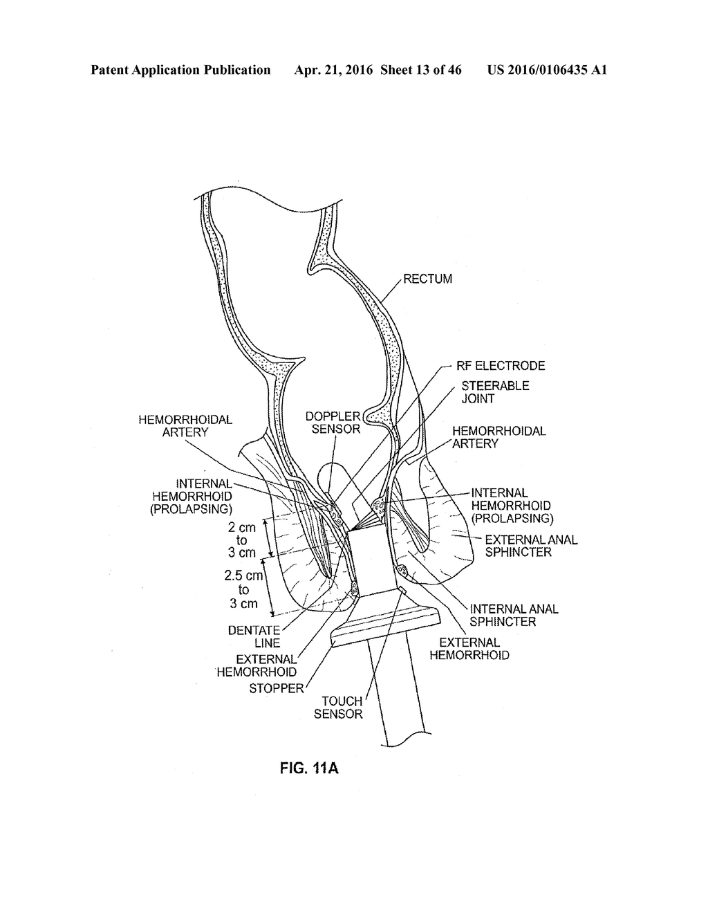 CLOSURE DEVICE AND METHOD - diagram, schematic, and image 14