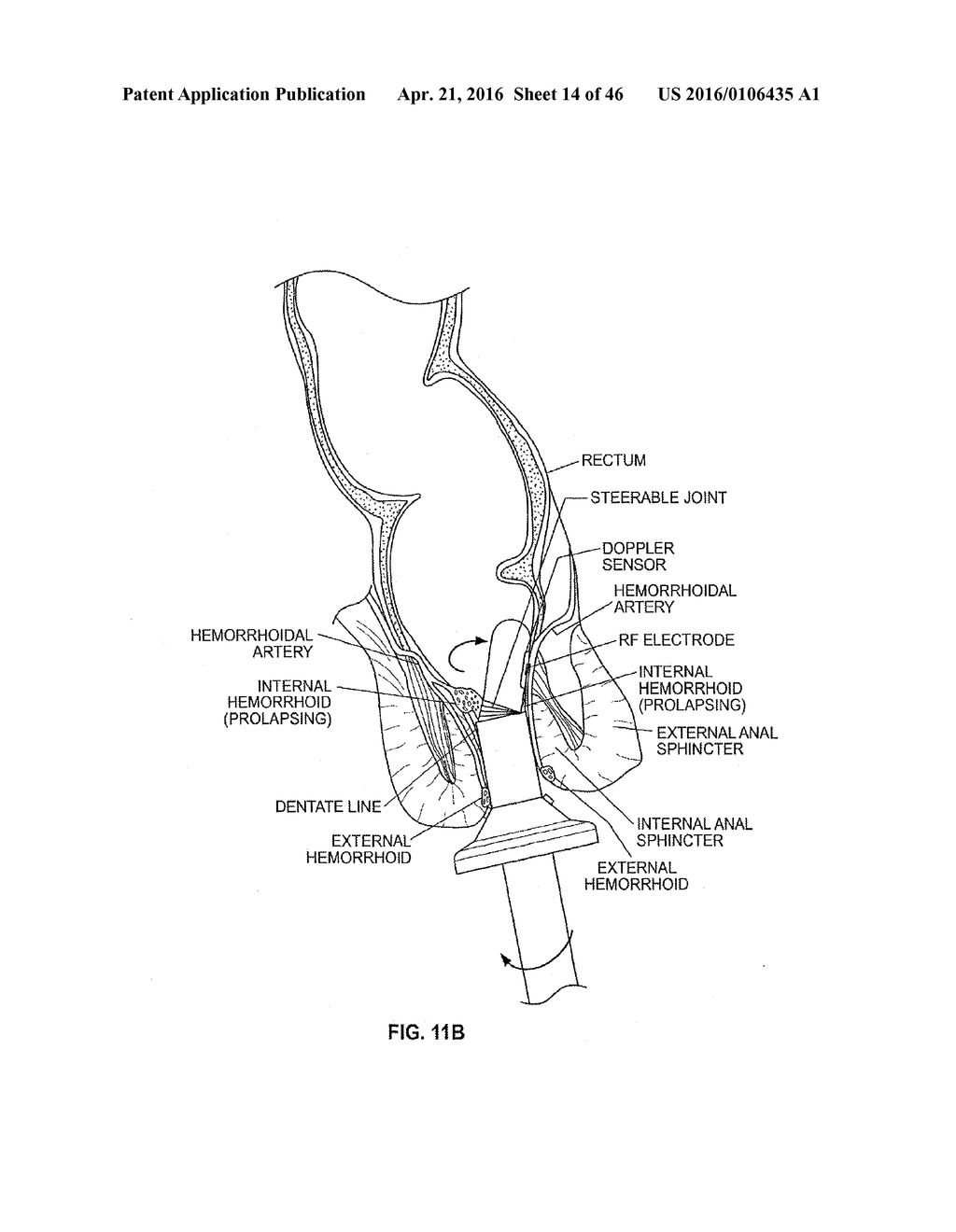 CLOSURE DEVICE AND METHOD - diagram, schematic, and image 15