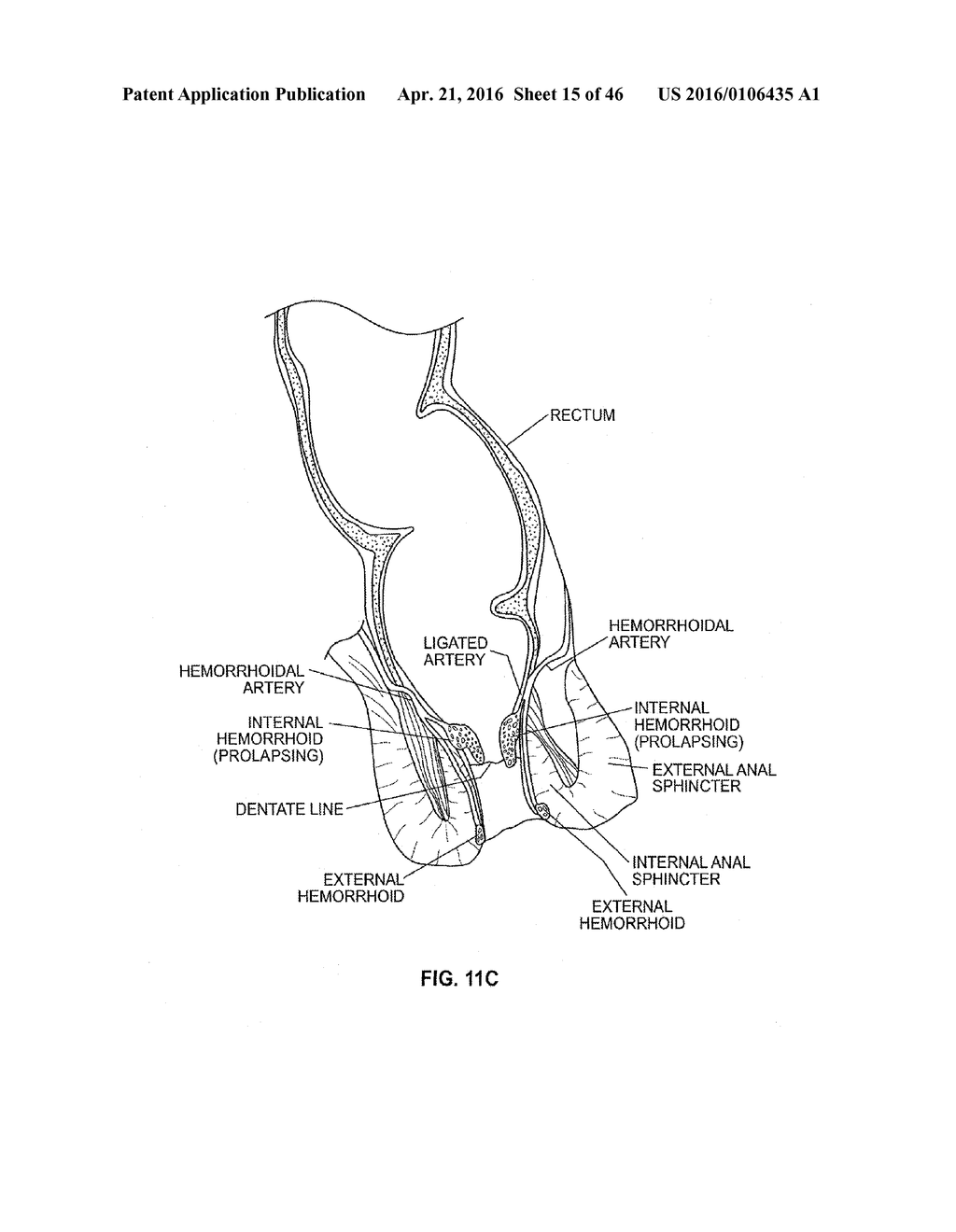 CLOSURE DEVICE AND METHOD - diagram, schematic, and image 16