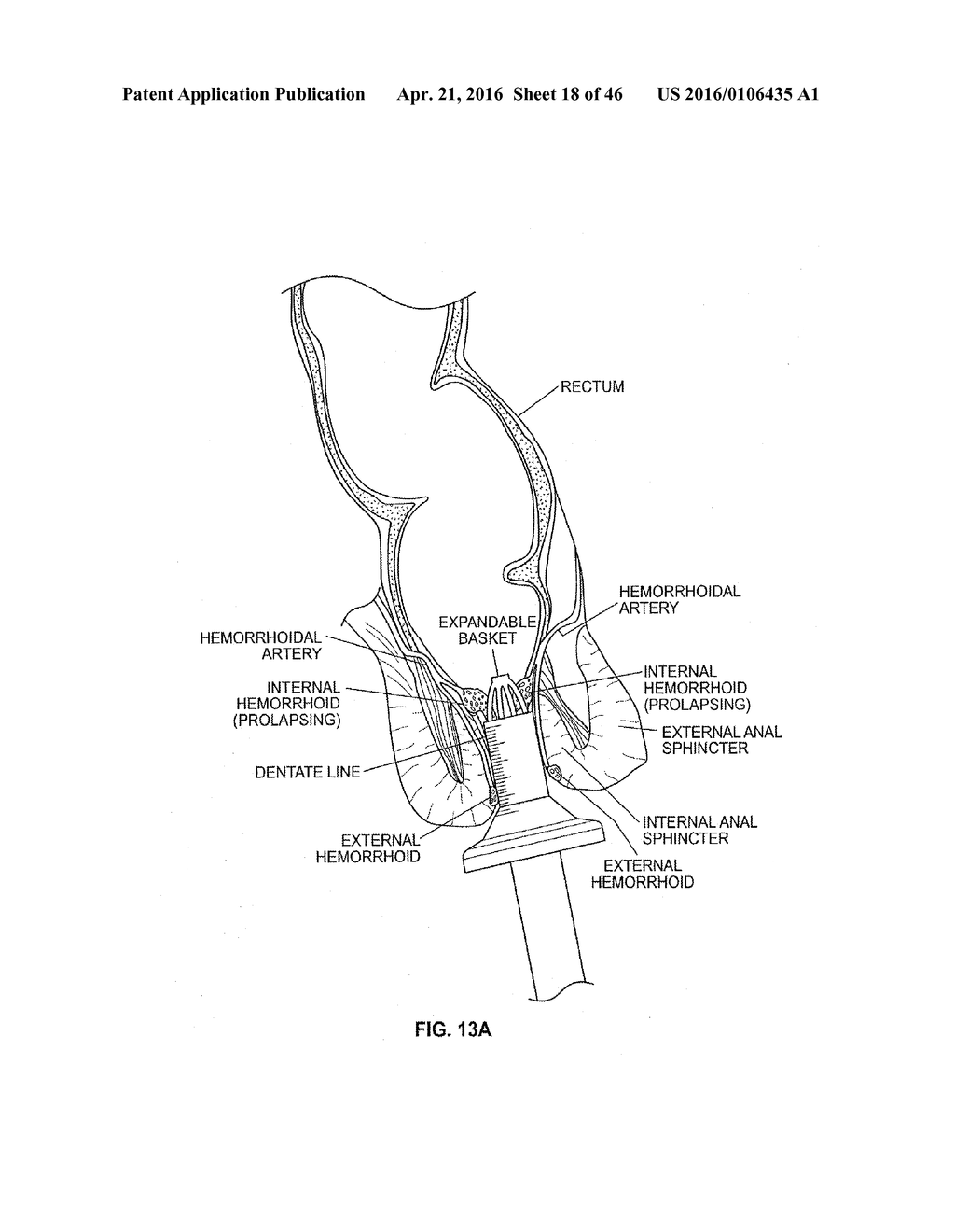 CLOSURE DEVICE AND METHOD - diagram, schematic, and image 19