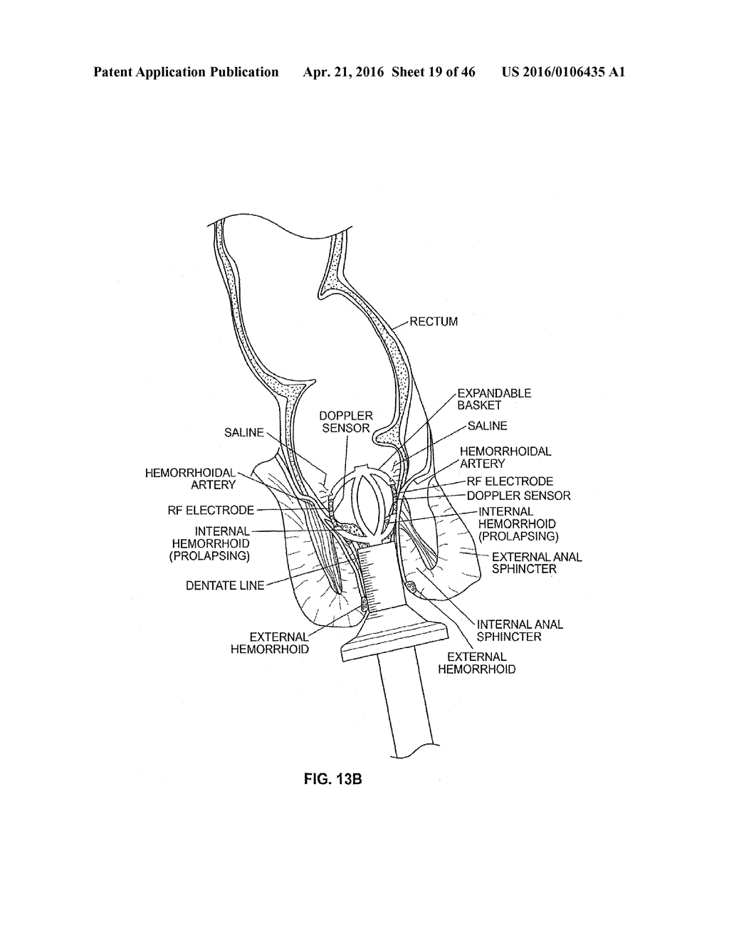 CLOSURE DEVICE AND METHOD - diagram, schematic, and image 20