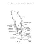 CLOSURE DEVICE AND METHOD diagram and image