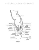 CLOSURE DEVICE AND METHOD diagram and image