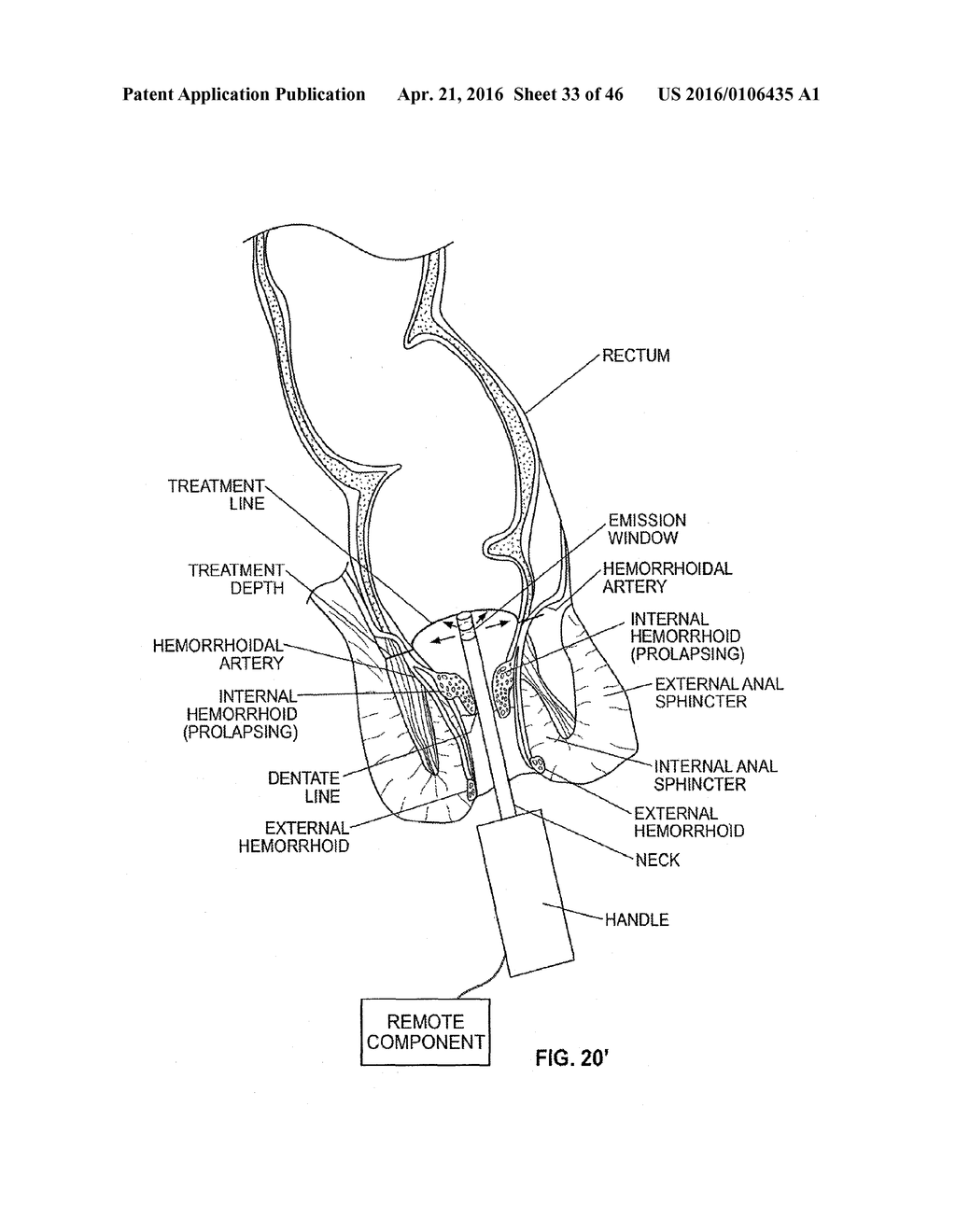 CLOSURE DEVICE AND METHOD - diagram, schematic, and image 34