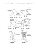 CLOSURE DEVICE AND METHOD diagram and image