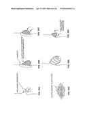 CLOSURE DEVICE AND METHOD diagram and image