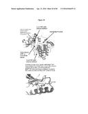 PNEUMATIC TOURNIQUET diagram and image