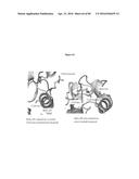 PNEUMATIC TOURNIQUET diagram and image