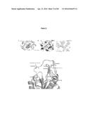 PNEUMATIC TOURNIQUET diagram and image