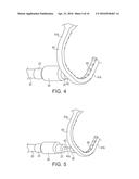 CERVICAL CERCLAGE ASSISTANCE DEVICE diagram and image