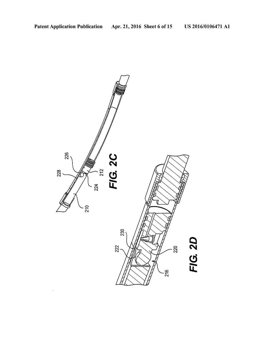 Orthopedic Extendable Rods - diagram, schematic, and image 07