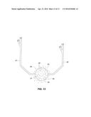 Systems and Methods for Performing Spinal Surgery diagram and image