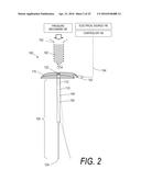 BONE TREATMENT SYSTEMS AND METHODS diagram and image