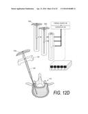 BONE TREATMENT SYSTEMS AND METHODS diagram and image